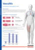 981515 - Flyer Vasculitis (EN)